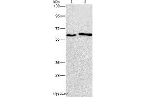 Western blot analysis of A172 and A549 cell, using CHRNA2 Polyclonal Antibody at dilution of 1:950 (CHRNA2 antibody)