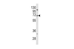 Western Blotting (WB) image for anti-Proprotein Convertase Subtilisin/kexin Type 9 (PCSK9) (AA 153-183), (N-Term) antibody (ABIN652320)