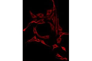 ABIN6275770 staining HepG2 by IF/ICC. (IL13RA2 antibody  (C-Term))
