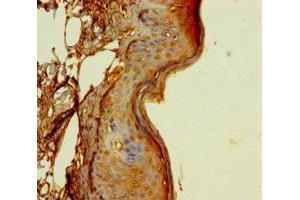 Immunohistochemistry of paraffin-embedded human skin tissue using ABIN7173528 at dilution of 1:100 (DUS4L antibody  (AA 1-196))