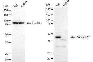 Western blotting analysis using Annexin A7 antibody (ABIN7797626). (Recombinant Annexin VII antibody)