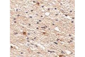 Immunohistochemistry of Aipl1 in human brain tissue with Aipl1 antibody at 2. (AIPL1 antibody  (C-Term))