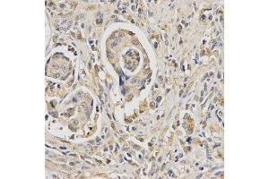 Immunohistochemistry (IHC) image for anti-HUS1 Checkpoint Homolog (S. Pombe) (HUS1) antibody (ABIN1876595) (HUS1 antibody)
