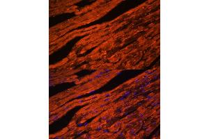 Immunofluorescence analysis of mouse heart cells using LDB3 antibody (ABIN6128179, ABIN6143125, ABIN6143126 and ABIN6223347) at dilution of 1:100. (LIM Domain Binding 3 Protein antibody  (AA 1-283))