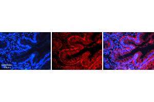 Rabbit Anti-NFKB2 Antibody   Formalin Fixed Paraffin Embedded Tissue: Human Appendix (Colon) Tissue Observed Staining: Cytoplasm Primary Antibody Concentration: 1:100 Other Working Concentrations: 1:600 Secondary Antibody: Donkey anti-Rabbit-Cy3 Secondary Antibody Concentration: 1:200 Magnification: 20X Exposure Time: 0.