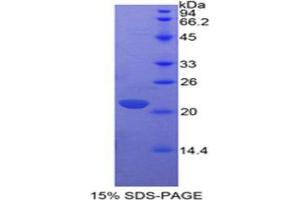 SDS-PAGE (SDS) image for Interleukin 17 (IL17) (AA 1-155) protein (His tag) (ABIN2125454)
