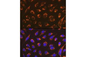 Immunofluorescence analysis of U-2 OS cells using Smac/Diablo Rabbit mAb (ABIN7270177) at dilution of 1:100 (40x lens). (DIABLO antibody)