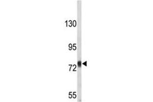 Western blot analysis of Amyloid beta precusor protein antibody in T47D lysate (APP antibody  (AA 735-763))