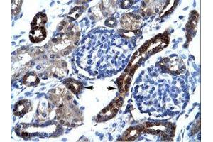 Image no. 1 for anti-A Kinase (PRKA) Anchor Protein 17A (AKAP17A) (AA 48-97) antibody (ABIN6735878) (SFRS17A antibody  (AA 48-97))