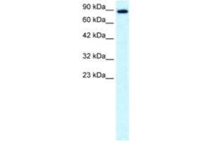 Western Blotting (WB) image for anti-Kinesin Family Member 21A (KIF21A) antibody (ABIN2460843) (KIF21A antibody)