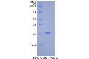 SDS-PAGE (SDS) image for Von Willebrand Factor (VWF) (AA 1498-1665) protein (His tag) (ABIN1081182)