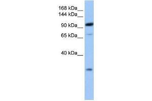 AP2B1 antibody used at 1 ug/ml to detect target protein. (AP2B1 antibody  (C-Term))