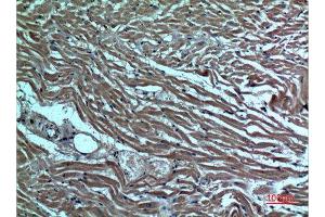 Immunohistochemistry (IHC) image for anti-Tumor Necrosis Factor Receptor Superfamily, Member 25 (TNFRSF25) (Internal Region) antibody (ABIN6282415)