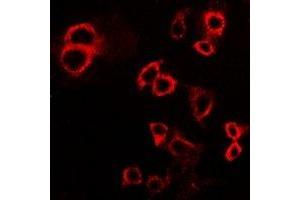 Immunofluorescent analysis of IFNGR1 staining in HepG2 cells.