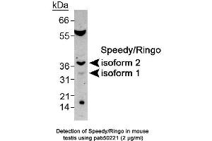 Image no. 1 for anti-Speedy Homolog B (Xenopus Laevis) (SPDYB) (AA 200-286), (both Isoforms), (C-Term) antibody (ABIN363530) (Speedy Homolog B (Xenopus Laevis) (SPDYB) (AA 200-286), (both Isoforms), (C-Term) antibody)