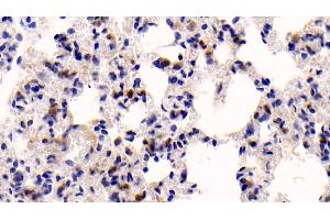 Detection of CASP3 in Rat Lung Tissue using Polyclonal Antibody to Caspase 3 (CASP3) (Caspase 3 antibody  (AA 183-277))