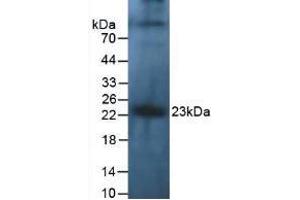 Figure. (IL-10 antibody  (AA 1-178))