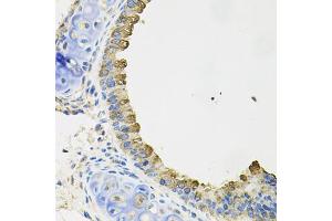 Immunohistochemistry of paraffin-embedded mouse lung using AIF1 antibody (ABIN5970719) at dilution of 1/100 (40x lens). (Iba1 antibody)