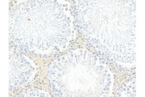 ABIN6263171 and ABIN6278338 at 1/100 staining Rat testis tissue by IHC-P.