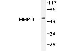 Image no. 1 for anti-Matrix Metallopeptidase 3 (Stromelysin 1, Progelatinase) (MMP3) antibody (ABIN265531) (MMP3 antibody)