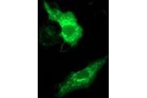 Anti-MMAB mouse monoclonal antibody (ABIN2454035) immunofluorescent staining of COS7 cells transiently transfected by pCMV6-ENTRY MMAB (RC204290). (MMAB antibody)