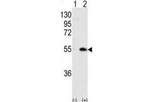 Western Blotting (WB) image for anti-Calcium/calmodulin-Dependent Protein Kinase IG (CAMK1G) antibody (ABIN3003081) (CAMK1G antibody)