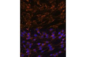 Immunofluorescence analysis of C6 cells using PREPL Polyclonal Antibody (ABIN7269561) at dilution of 1:100 (40x lens). (PREPL antibody  (AA 578-727))