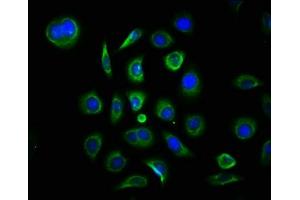 Immunofluorescence staining of A549 cells with ABIN7159004 at 1:133, counter-stained with DAPI. (MAP3K7CL antibody  (AA 1-142))