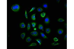 Immunofluorescence staining of A549 cells with ABIN7159004 at 1:133, counter-stained with DAPI.