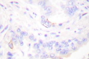 Image no. 1 for anti-V-Crk Sarcoma Virus CT10 Oncogene Homolog (Avian) (CRK) antibody (ABIN265373)