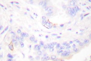 Image no. 1 for anti-V-Crk Sarcoma Virus CT10 Oncogene Homolog (Avian) (CRK) antibody (ABIN265373) (Crk antibody)