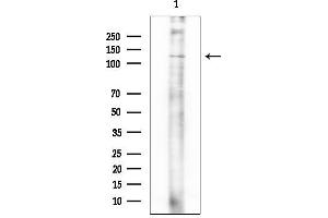 Western blot analysis of lysates from COLO205 cells(heat-shock treatment), using MLK3 Mouse Monoclonal Antibody.