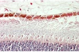(ABIN571175) (5 μg/mL) staining of paraffin embedded Human Retina. (RDH5 antibody  (AA 19-31))