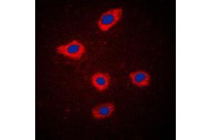 Immunofluorescent analysis of Mammaglobin A staining in MCF7 cells. (Mammaglobin A antibody  (Center))