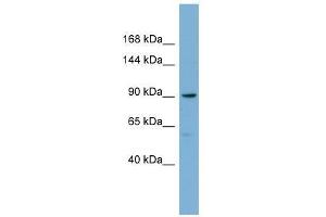 Western Blot showing E2F8 antibody used at a concentration of 1-2 ug/ml to detect its target protein. (E2F8 antibody  (Middle Region))