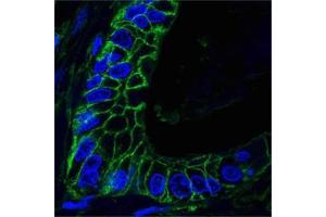 Confocal analysis of paraffin-embedded human lung cancer tissues using CD44 antibody (green), showing membrane localization.