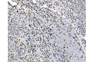 IHC analysis of JUNB using anti-JUNB antibody (ABIN7603223).
