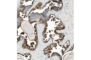 IHC analysis of ANPEP using anti-ANPEP antibody (ABIN7600087).