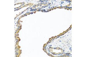 Immunohistochemistry of paraffin-embedded human prostate using NYX antibody at dilution of 1:100 (40x lens). (Nyctalopin antibody)