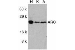 Western blot analysis of ARC in HeLa (H), KB (K), and A549 (A) whole cell lysates with ARC antibody at 1ug/ml. (NOL3 antibody  (C-Term))