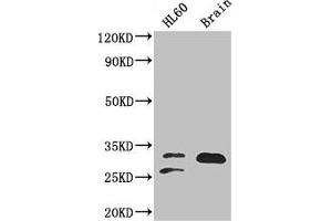 Western Blot Positive WB detected in: HL60 whole cell lysate, Mouse brain tissue All lanes: TPI1 antibody at 2 μg/mL Secondary Goat polyclonal to rabbit IgG at 1/50000 dilution Predicted band size: 31, 27, 18 kDa Observed band size: 31, 27 kDa (TPI1 antibody  (AA 169-228))