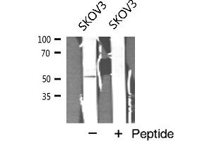 Western blot analysis of Cyclin A1 expression in SKOV3 cell extract (Cyclin A1 antibody)