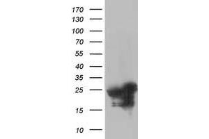 Western Blotting (WB) image for anti-Adenylate Kinase 4 (AK4) antibody (ABIN1496529)