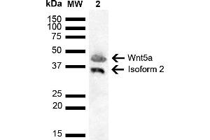 Western blot analysis of Human Cervical cancer cell line (HeLa) lysate showing detection of ~42. (WNT5A antibody  (AA 200-300) (FITC))