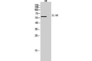 Western Blotting (WB) image for anti-Interleukin 9 Receptor (IL9R) (Internal Region) antibody (ABIN3178952) (IL9 Receptor antibody  (Internal Region))