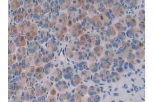 DAB staining on IHC-P; Samples: Mouse Stomach Tissue (Importin 8 antibody  (AA 417-622))