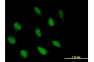 Immunofluorescence of purified MaxPab antibody to ABI2 on HeLa cell. (ABI2 antibody  (AA 1-475))