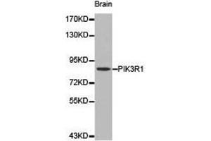 Western Blotting (WB) image for anti-Phosphoinositide 3 Kinase, p85 alpha (PI3K p85a) antibody (ABIN1874135) (PIK3R1 antibody)