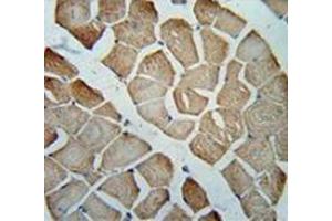 Immunohistochemistry analysis in human skeletal muscle (Formalin-fixed, Paraffin-embedded) using Metaxin-2 Antibody (C-term), followed by peroxidase conjugated secondary antibody and DAB staining. (MTX2 antibody  (C-Term))