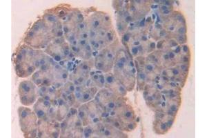 Detection of LOX in Mouse Pancreas Tissue using Polyclonal Antibody to Lysyl Oxidase (LOX) (LOX antibody  (AA 207-411))